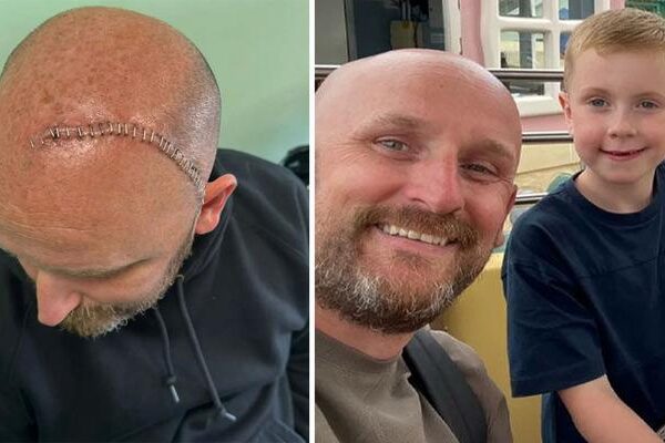 Baş dönmesi şikayetiyle hastaneye gitti: 6 yıl ömrün kaldığını söylediler! Gerçek teşhis sonradan ortaya çıktı!